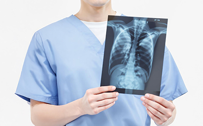 X-ray 검사